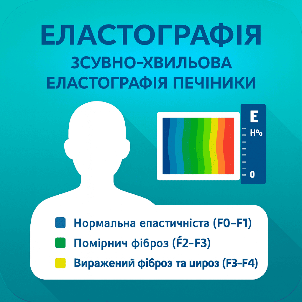 Зсувно-хвильова еластографія печінки (Shear Wave Elastography)